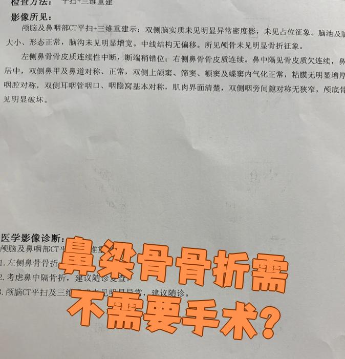深圳新鹏城：廖力生已完成手术出院修复骨折鼻骨的简单介绍  第1张